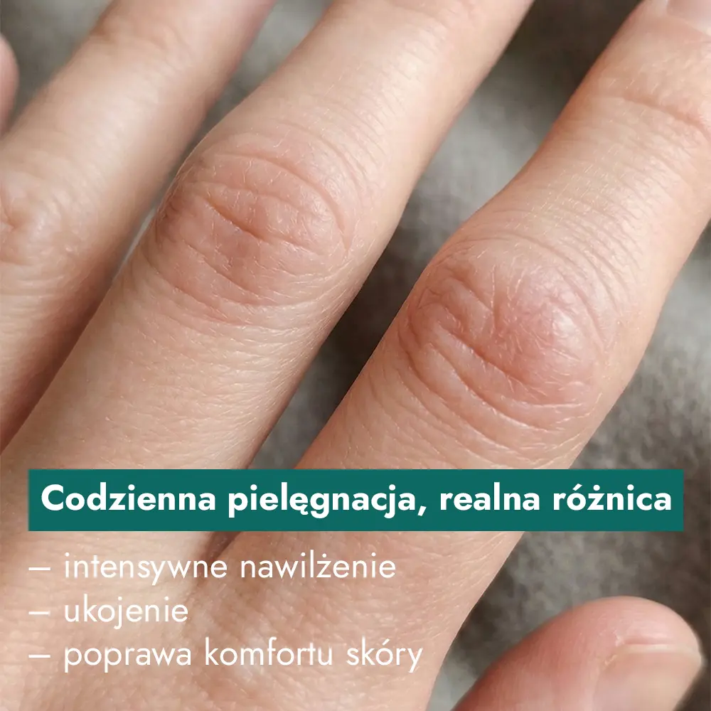 Co daje krem do rąk - infografika